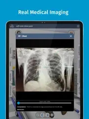 full code medical simulation ipad images 4