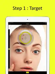 zit zapper - remove pimples ipad images 2