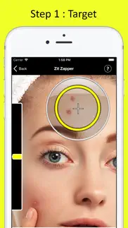 zit zapper - remove pimples iphone images 2