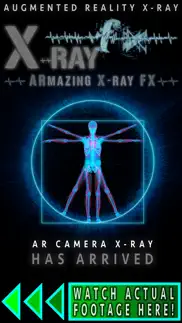 armazing x-ray fx iPhone Captures Décran 1