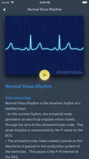 acls rhythms and quiz iphone images 4