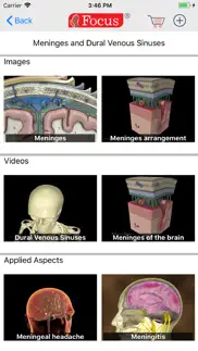 neuroanatomy - digital anatomy iphone images 3