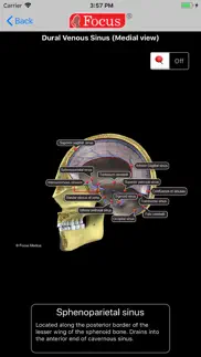 neuroanatomy - digital anatomy iphone images 4