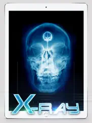 best x-ray ipad images 4
