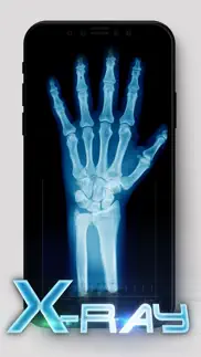 best x-ray iphone images 3