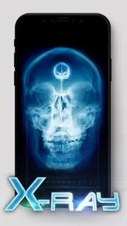 best x-ray iphone images 4