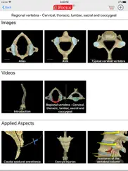 back and spinal cord ipad images 3