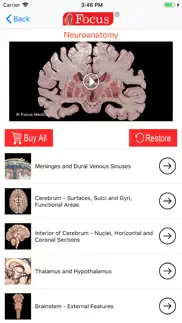 neuroanatomy - digital anatomy iphone images 2