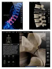 spine pro iii iPad Captures Décran 4