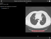 fibrose pulmonaire 2017 ipad images 1