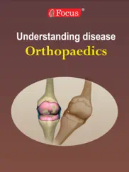 orthopaedics - understanding disease ipad images 1