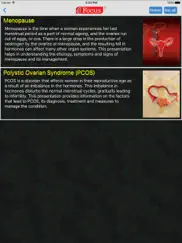 gynaecology - understanding disease ipad images 2