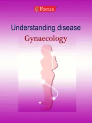 gynaecology - understanding disease ipad images 1
