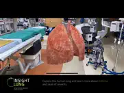 insight lung ipad resimleri 4