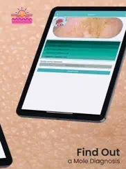 scanner de tu piel ipad capturas de pantalla 2