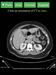 radiology ct viewer ipad images 1