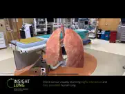 insight lung ipad resimleri 2