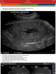 poc ultrasound guide ipad images 1