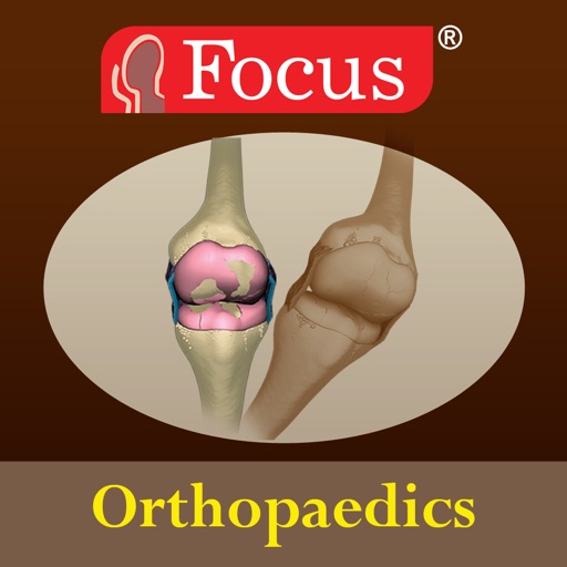 Orthopaedics - Understanding Disease app reviews download