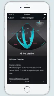 echo views - transesophageal echocardiography iphone capturas de pantalla 2