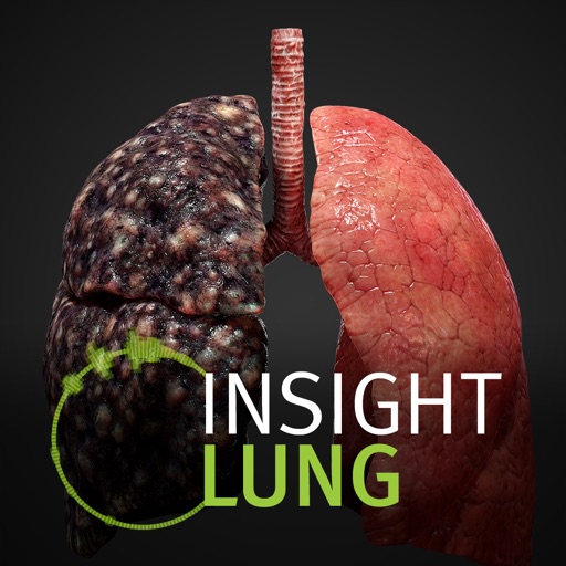 INSIGHT LUNG app reviews download