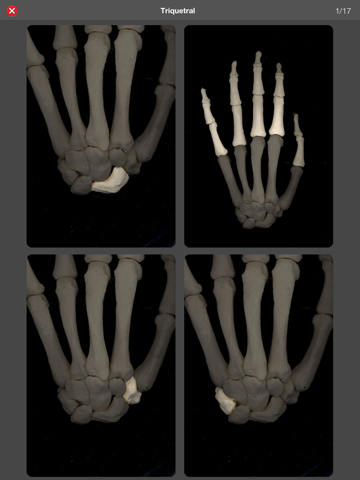 quizz anatomique pro iPad Captures Décran 4