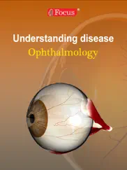ophthalmology - understanding disease ipad images 1