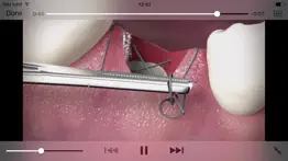 the oral surgery suture trainer iphone resimleri 2
