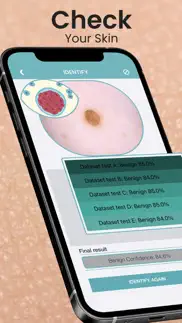 scanner de tu piel iphone capturas de pantalla 1