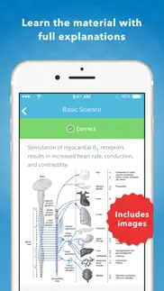 crna nurse anesthesia review iphone images 2