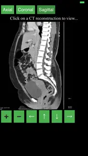 ct abdomen pelvis iphone images 3