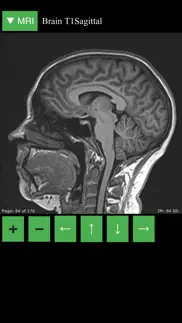 mri viewer iphone images 2
