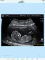 Советы «беременым» папам hовый айпад изображения 2