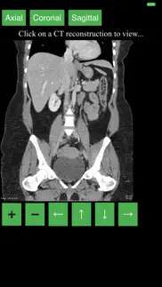 ct abdomen pelvis iphone images 2