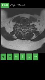 mri viewer iphone images 4
