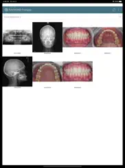 dental photos iPad Captures Décran 3