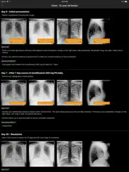 normal x-rays and real cases ipad resimleri 4