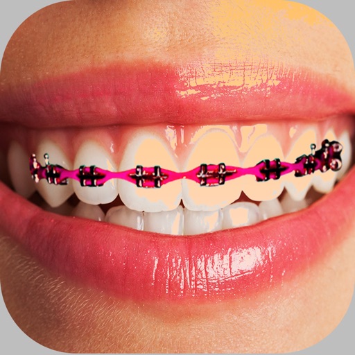 Braces Photo Editor - Stickers app reviews download