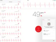 cardiographe iPad Captures Décran 3