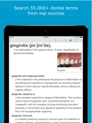 dental dictionary by farlex ipad resimleri 1