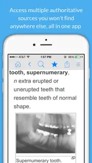 dental dictionary by farlex iphone resimleri 2