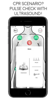 awesome ultrasound simulator iphone bildschirmfoto 3