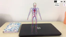 ar vascular system iphone images 1