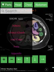 anatomy on radiology ct ipad images 3