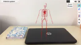 ar vascular system iphone images 2