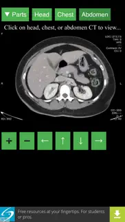 anatomy on radiology ct iphone images 2