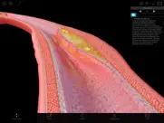 physiologie & pathologie iPad Captures Décran 2