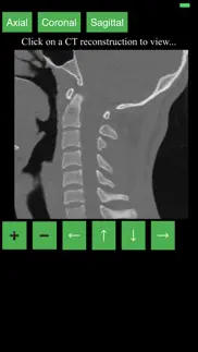ct cervical spine iphone images 2