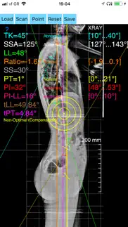 sagittalbalanceapp iphone images 1