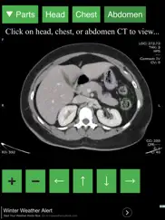 anatomy on radiology ct ipad images 2